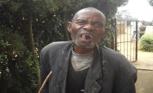 Rutsiro Yarakubiswe Akurwa Amenyo Azira Amakuru Yatanze Muri