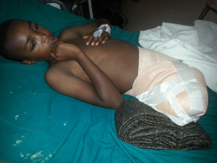 Ngabonziza akeneye insimburangingo nyuma yo kugongwa n'ikamyo ya UNHCR.