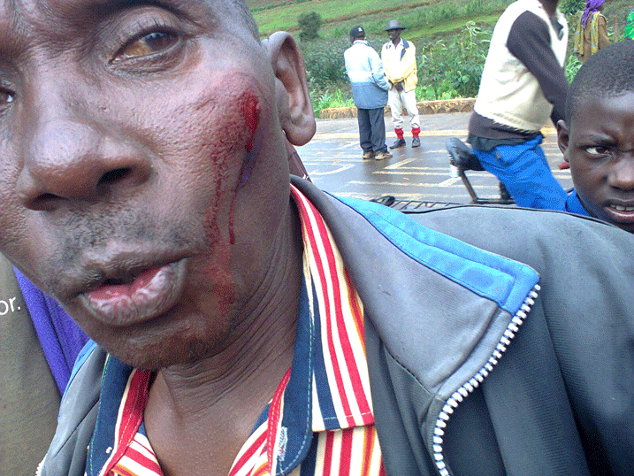 Imvura yanakomerekeje bamwe bu baturage.