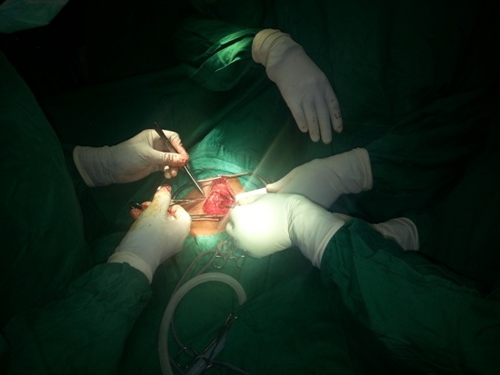 Aha Dr. Tugilimana yari kubaga umurwayi indwara y'umwingo, imwe mu byo azobereyemo.