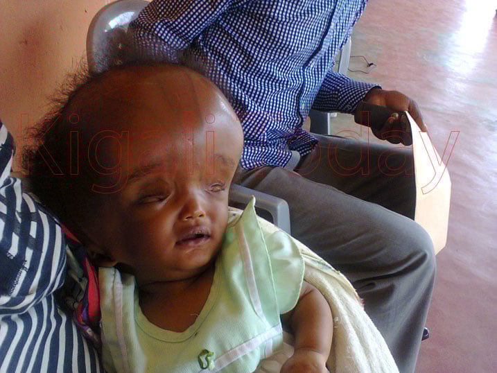 Uyu mwana afite amezi umunani ariko aho gukura abyimba umutwe.