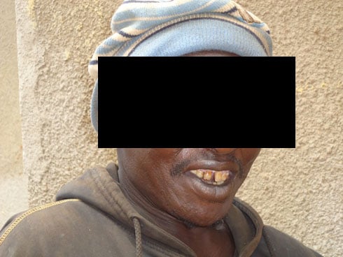 Gituza avuga ko umuntu atakwibuka koza amenyo yabuze icyo arya kuko abakire boza amenyo kuko bariye.