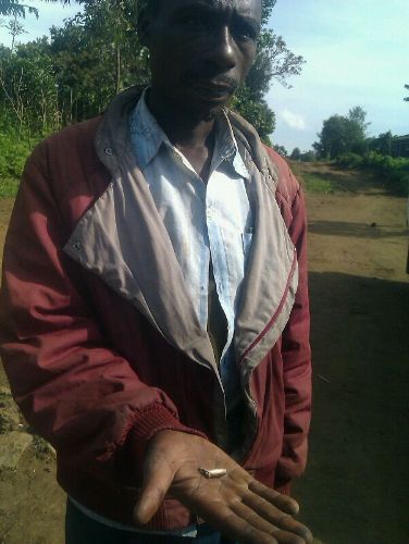 Umwe mu baturage yerekana amasasu yarashwe mu Rwanda.