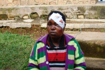 Tuyishimire yari yakubiswe n'umugabo we amukomeretsa mu mutwe.