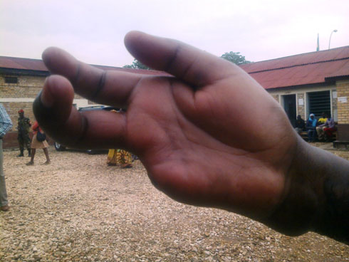 Zimwe mu ngaruka Umukundwa Béatha avuga ko yagize nyuma yo guterwa umuti mu bitaro bya Kabgayi.