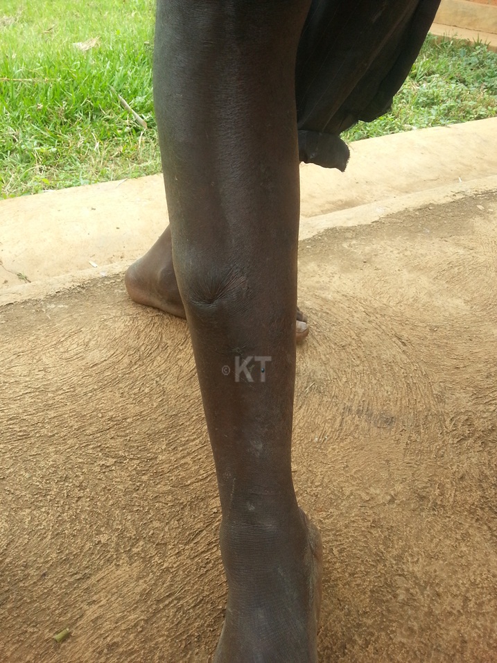 Uyu mugabo avuga ko iyo amenyo y'ingona agera ku igufwa bitari kumworohera.