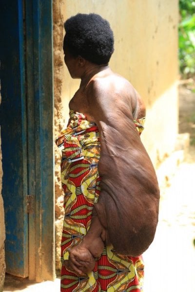 Umuryango wa Bakundukize ukeneye gufashwa kuko wagiye mu bukene kubera uburwayi bwe
