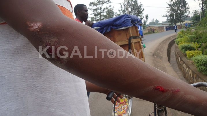 Dore uko ukuboko kwe ku iburyo kwabaye.