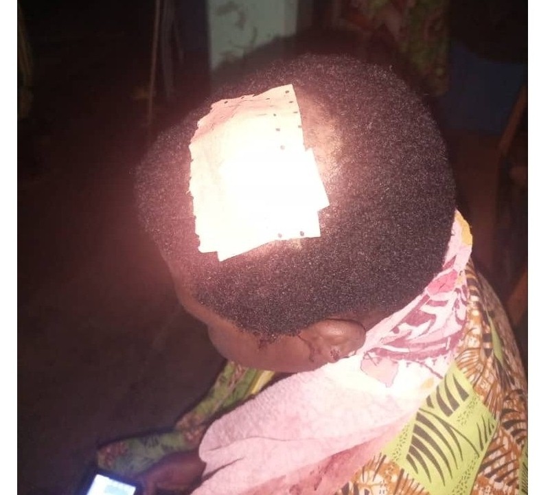Umwe mu bakomerekeye muri ayo makimbirane yahise ajyanwa kwa muganaga