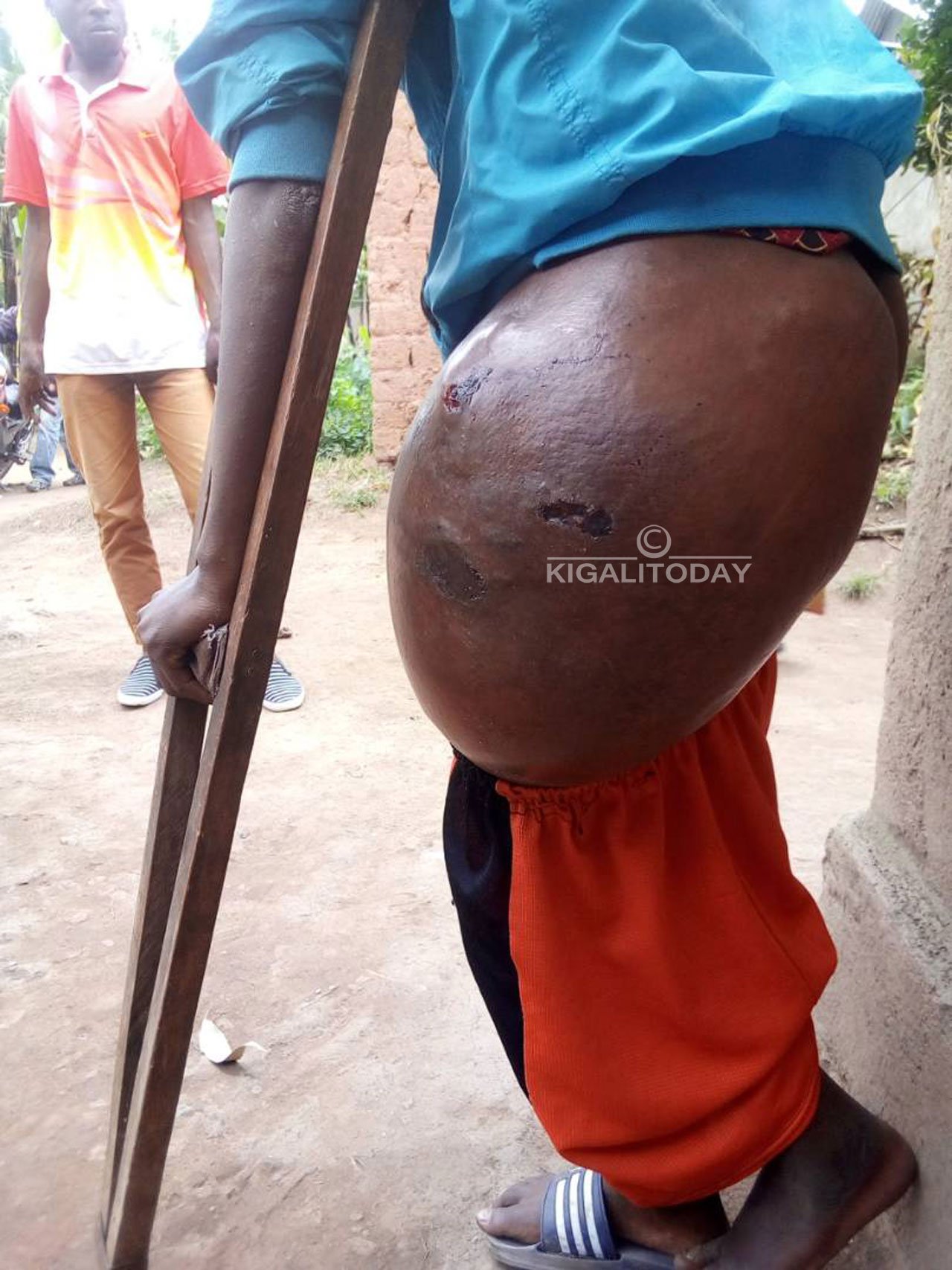 Ibitaro yivurijemo bivuga ko ntakindi byamumarira