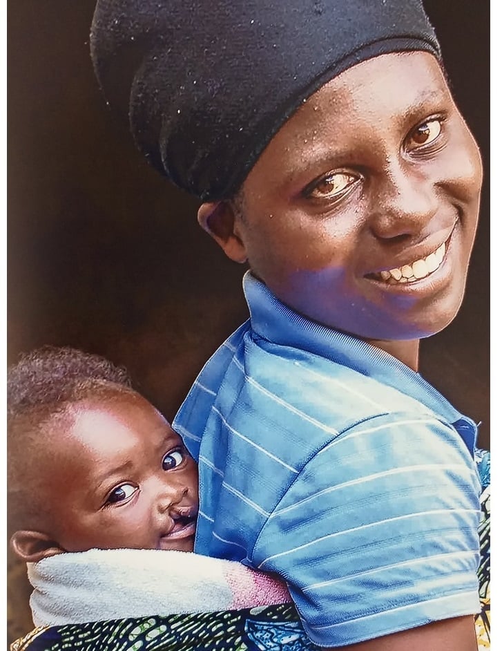 Yishimiye ko haje abaganga babaga indwara zo ku ruhu
