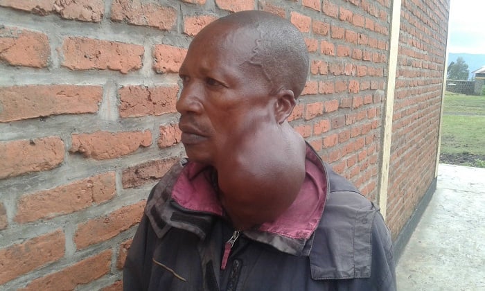 Uwarayeneza avuga ko nta bushobozi bwo kwivuza iki kibyimba afite