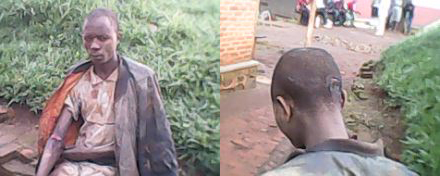 Kayisire yatemaguwe ku mubiri no mu mutwe.
