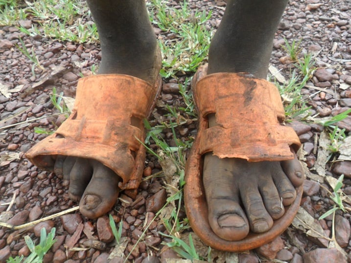 Kutitabwaho kwa bamwe mu bana bibatera kurwara amavunja.