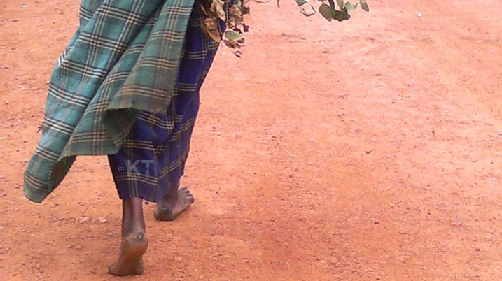 Muri imwe mu mirenge y'akarere ka Burera haracyagaragara abantu barwaye amavunja 