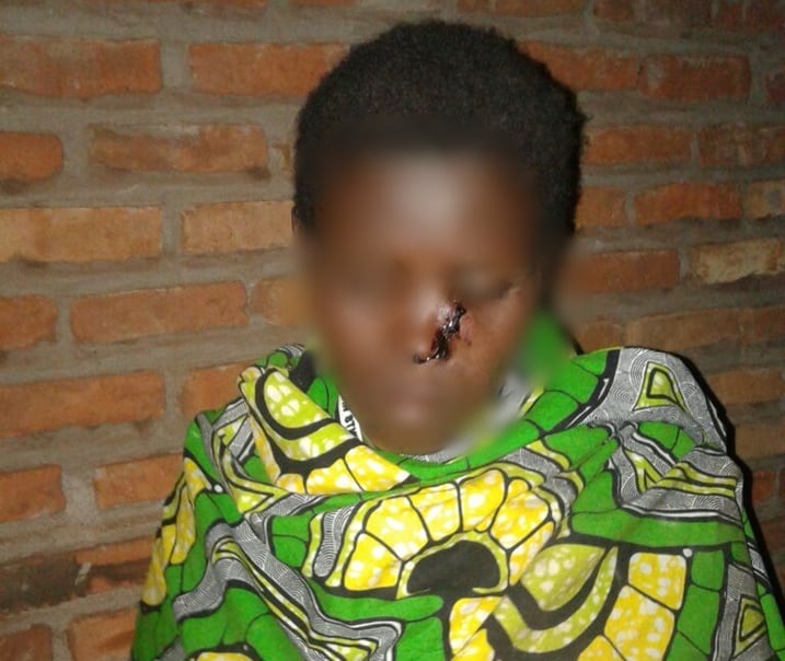 Uyu ni umugore umugabo we yateye icyuma ku zuru.