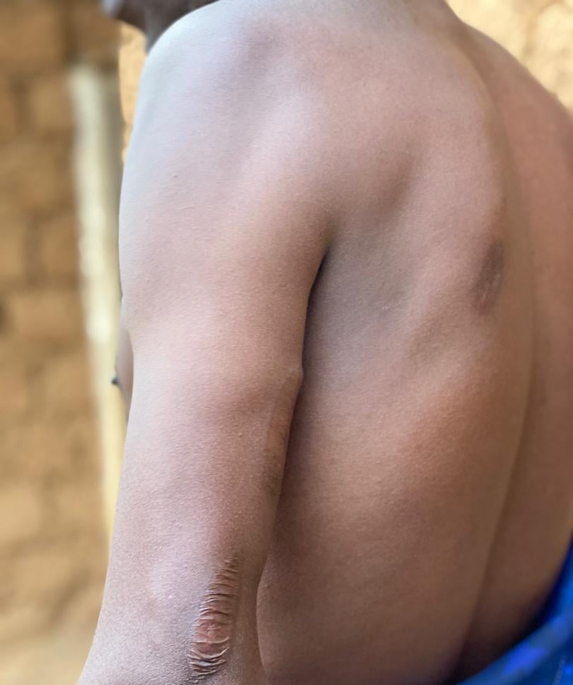 Ntirandekura yarashwe amasasu ane Imana ikinga ukuboko