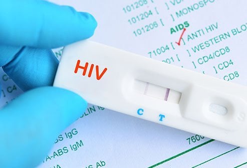 Uburyo bwa Rapid Test ni bwo urubyiruko rusigaye rukunda gukoresha