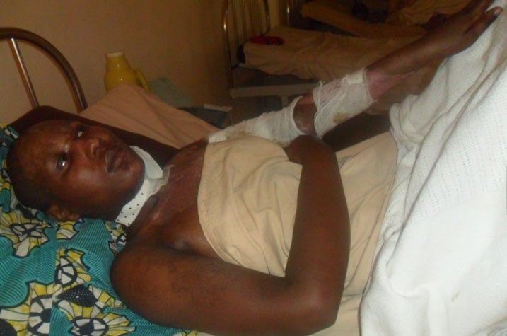 Tuyishimire ngo arumva ububabare butangiye koroha.
