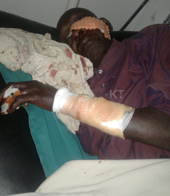 Umusaza w'imyaka 70 wariwe n'imbwa akaba ari mu bitaro hamwe n'abandi zakomerekeje.