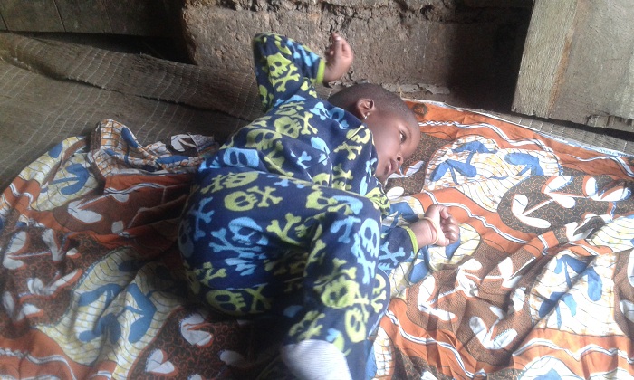 Mbere yo kuvurwa, uyu mwana yahoraga aryamye kuko atabashaga kwicara