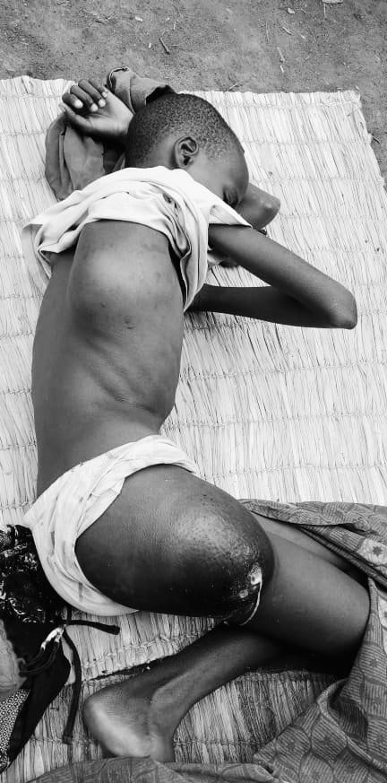 Afite uburwayi bw