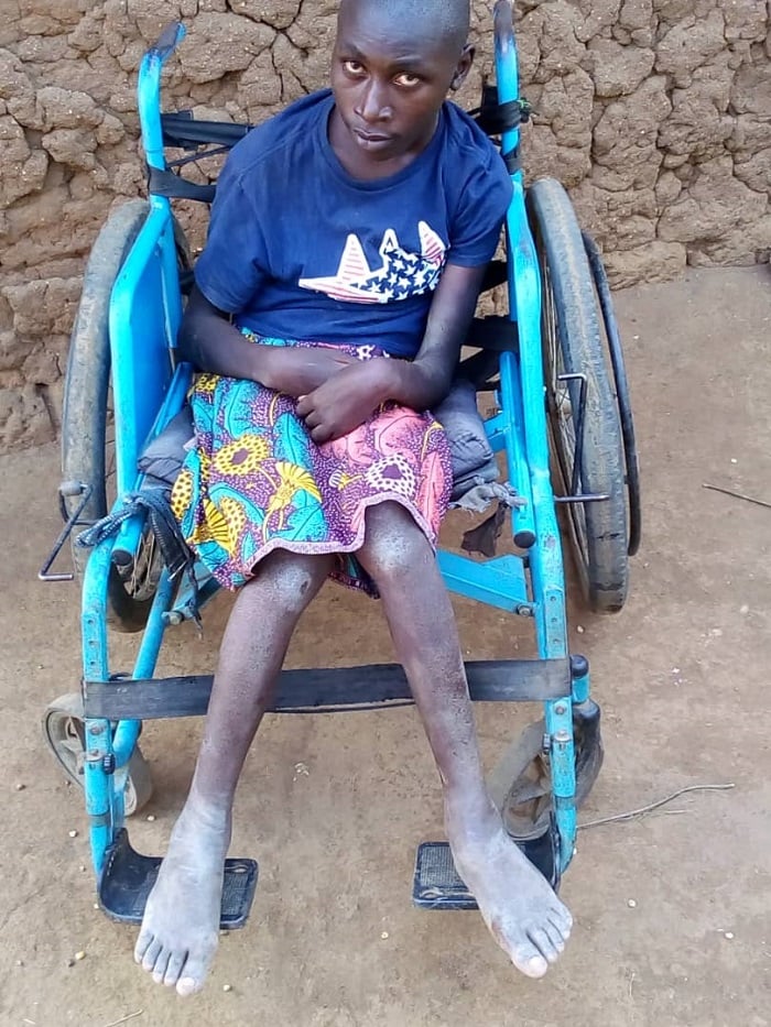 Habamahirwe Jonas ufite imyaka 16 ubu ntabasha kugenda cyangwa kugira icyo akora kuko ingingo zitagikora