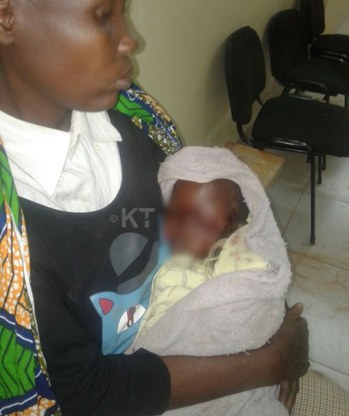 umwe mu bana bariwe n'imbwa uteruwe na nyina bari kwa muganga.