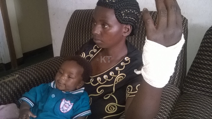 Uwineza avuga ko yarashwe amaboko arwana n